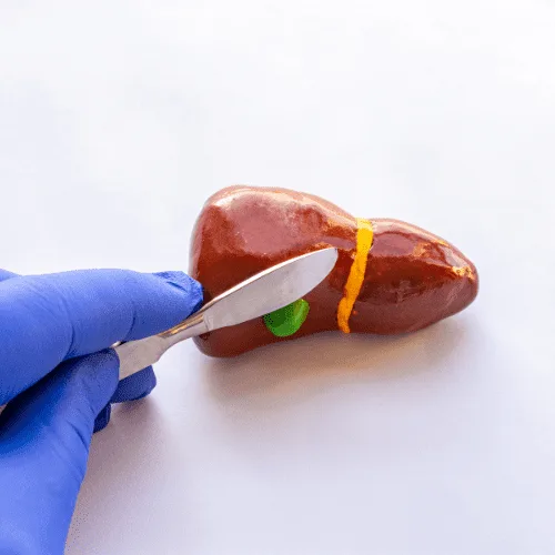 ¿Qué especialista trata la hepatitis?