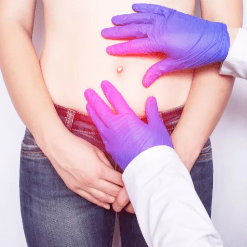 Pólipos intestinales: Detección y prevención experta en Guadalajara